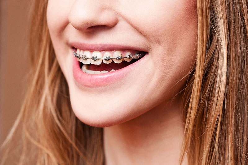 Orthodontics in Huntington Park